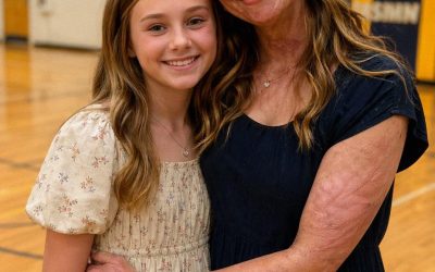 Mi hija me suplicó que no fuera a su escuela por mi rostro con cicatrices – Entonces, un desconocido entró a su escuela y dijo: “Tu madre ha estado ocultando la verdad durante 20 años”