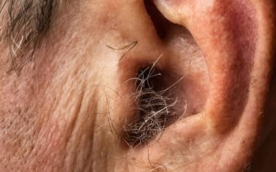 ¿Sabías que si te crece pelo en las orejas no es señal de enfermedad ni un misterio, sino el resultado natural del envejecimiento, las hormonas, la genética y el paso del tiempo, que actúan silenciosamente dentro del cuerpo humano durante muchas décadas?