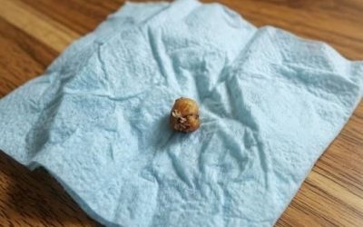 Tras un descubrimiento aterrador durante una ducha rutinaria que convenció a una pareja de que algo horrible vivía en su cabello, una búsqueda interminable en Google, un pánico creciente y un pequeño parásito aplastado finalmente revelaron la inquietante verdad sobre la criatura oculta en su cuero cabelludo y el temor creciente de que a veces las cosas más aterradoras pasan completamente desapercibidas hasta que es casi demasiado tarde para siempre.