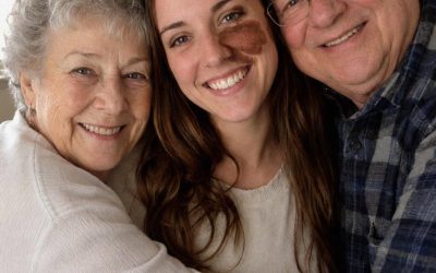 Adoptamos a una niña que nadie quería por una marca de nacimiento – 25 años después, una carta reveló la verdad sobre su pasado