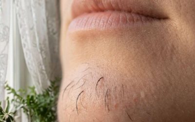 Lo que el vello de la barbilla en las mujeres realmente dice sobre las hormonas: