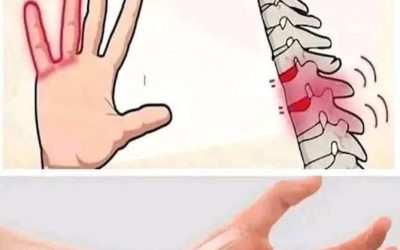 Posibles razones por las que podrías sentir entumecimiento u hormigueo en las manos.