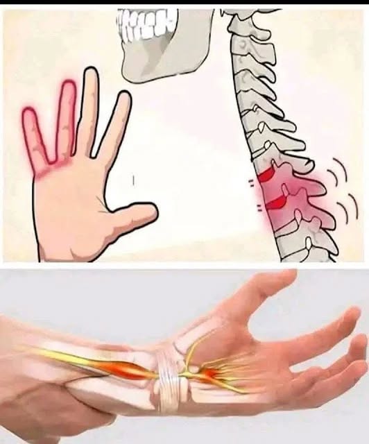 Posibles razones por las que podrías sentir entumecimiento u hormigueo en las manos.