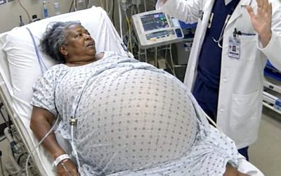 Una mujer de 65 años se quedó atónita al descubrir que estaba embarazada, pero cuando llegó el momento del parto, el examen médico reveló algo que dejó a todos en estado de shock.