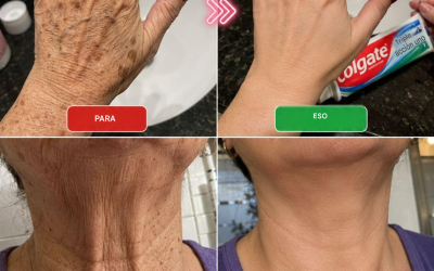 “Parece que me han operado”: ​​un remedio casero para reducir las arrugas y las manchas oscuras en manos y brazos.