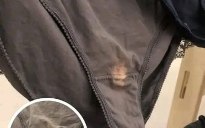 Qué significa una mancha de lejía en tu ropa interior