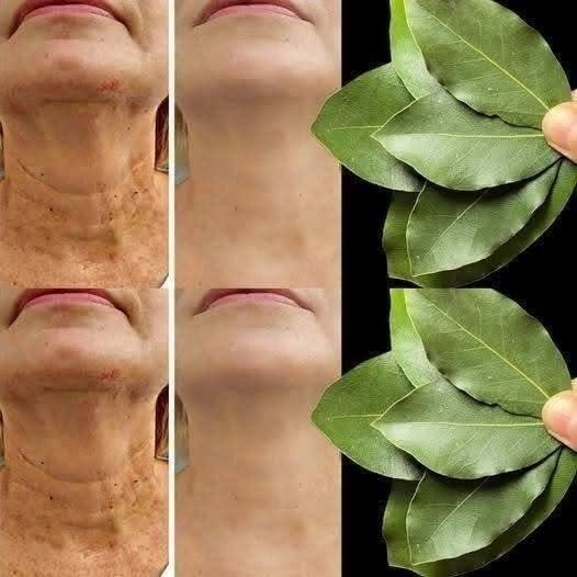 Es el laurel 100.000 veces más efectivo que el bótox? | Eliminador de arrugas natural, ¡incluso a los 70!