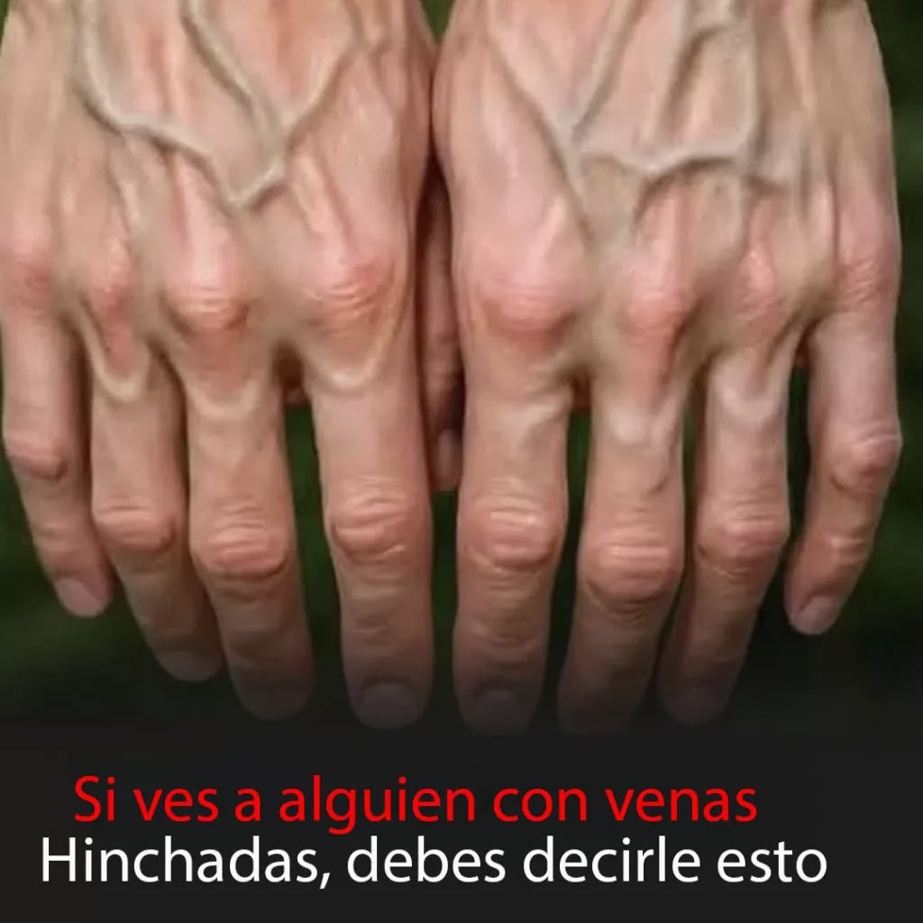 ¿Tus venas se ven más de lo normal? Esto es lo que tu cuerpo podría estar tratando de decirte